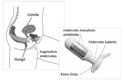Dubens dugno raumenų stimuliacijos aparatas NeuroTrac CONTINENCE