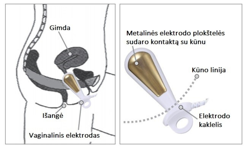 Vaginalinis elektrodas elektrinei stimuliacijai arba stimuliacijai su EMG